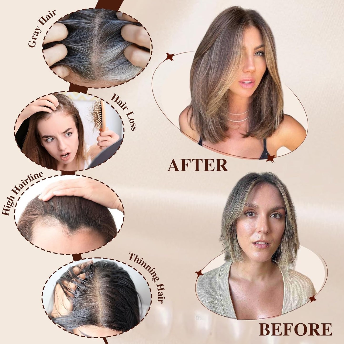 14/18 Inch Hair Toppers for Women Synthetic Hair Toppers Hair Pieces