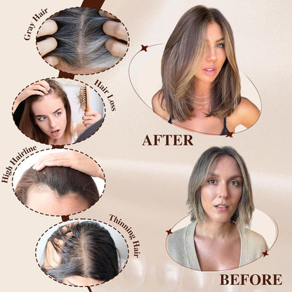 14/18 Inch Hair Toppers for Women Synthetic Hair Toppers Hair Pieces